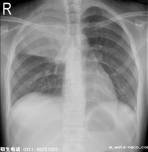 2019护士资格考点精练4.png 2019护士资格考点精练4.png