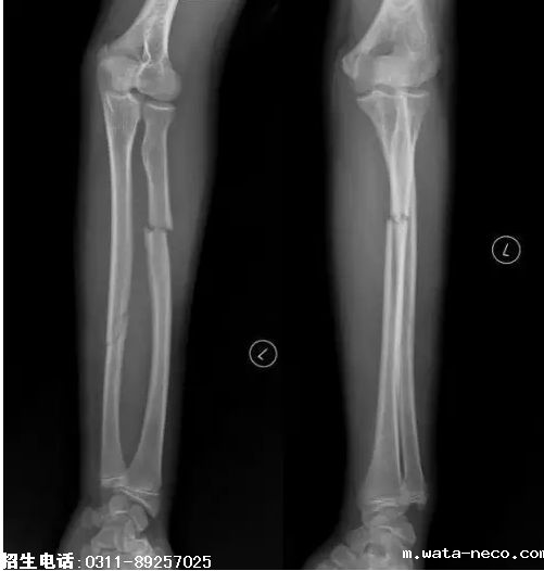 2019护士资格考点精练6.png 2019护士资格考点精练6.png