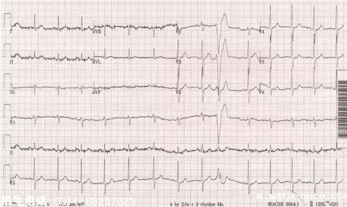 2019护士资格考点精练7.png 2019护士资格考点精练7.png