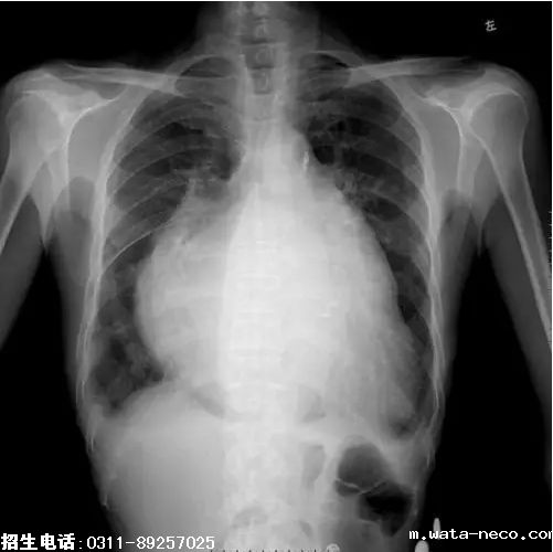 2019护士资格考点精练8.png 2019护士资格考点精练8.png