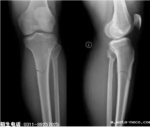 2019护士资格考点精练10.png 2019护士资格考点精练10.png