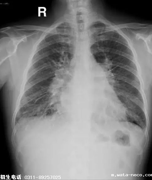 2019护士资格考点精练.png 2019护士资格考点精练.png